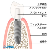 イメージ画像