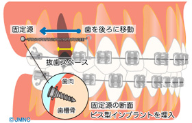 イメージ画像